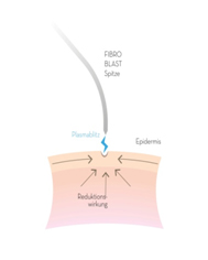 fibroblast